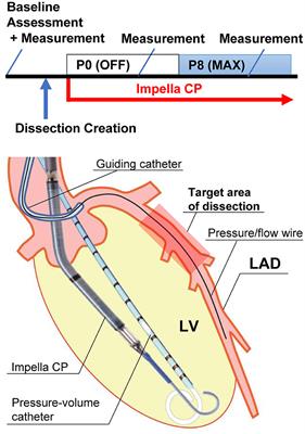 Novel <mark class="highlighted">Porcine Model</mark> of Coronary Dissection Reveals the Impact of Impella on Dissected Coronary Arterial Hemodynamics